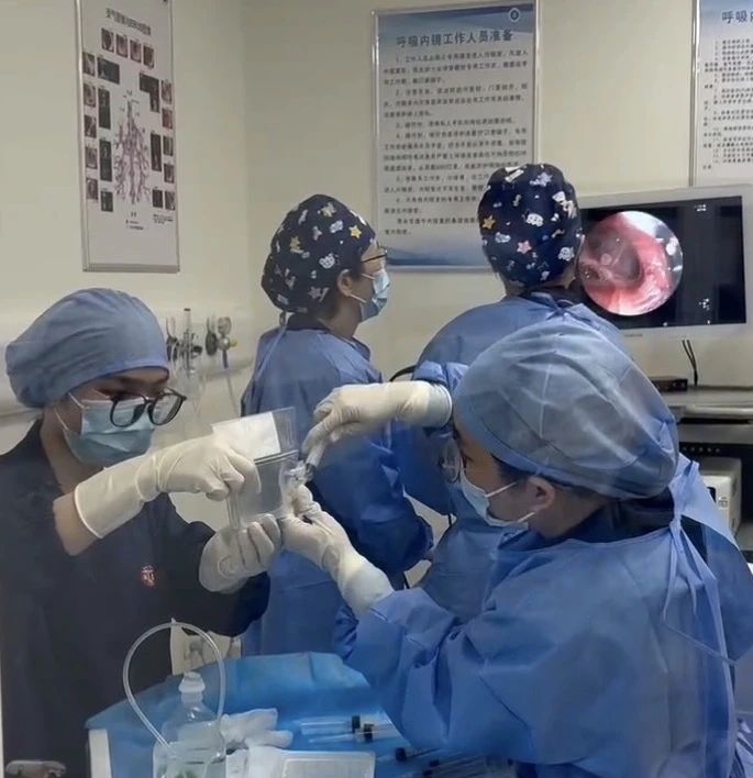首例慢阻肺病患者順利完成干細胞治療，由瑞金醫院周敏教授(左二）完成支氣管鏡給藥操作