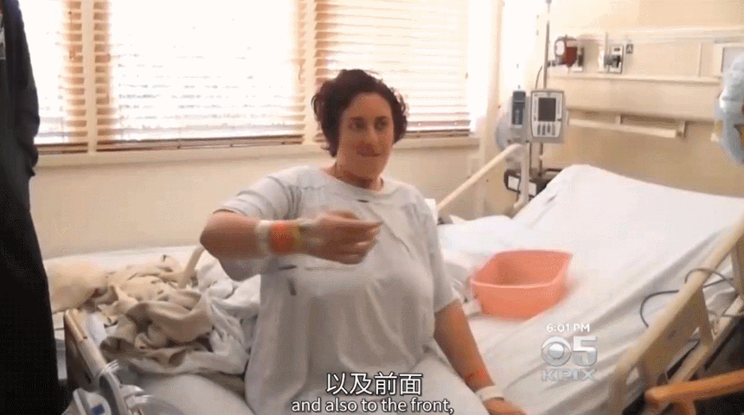 干細胞治療后 干細胞治療后