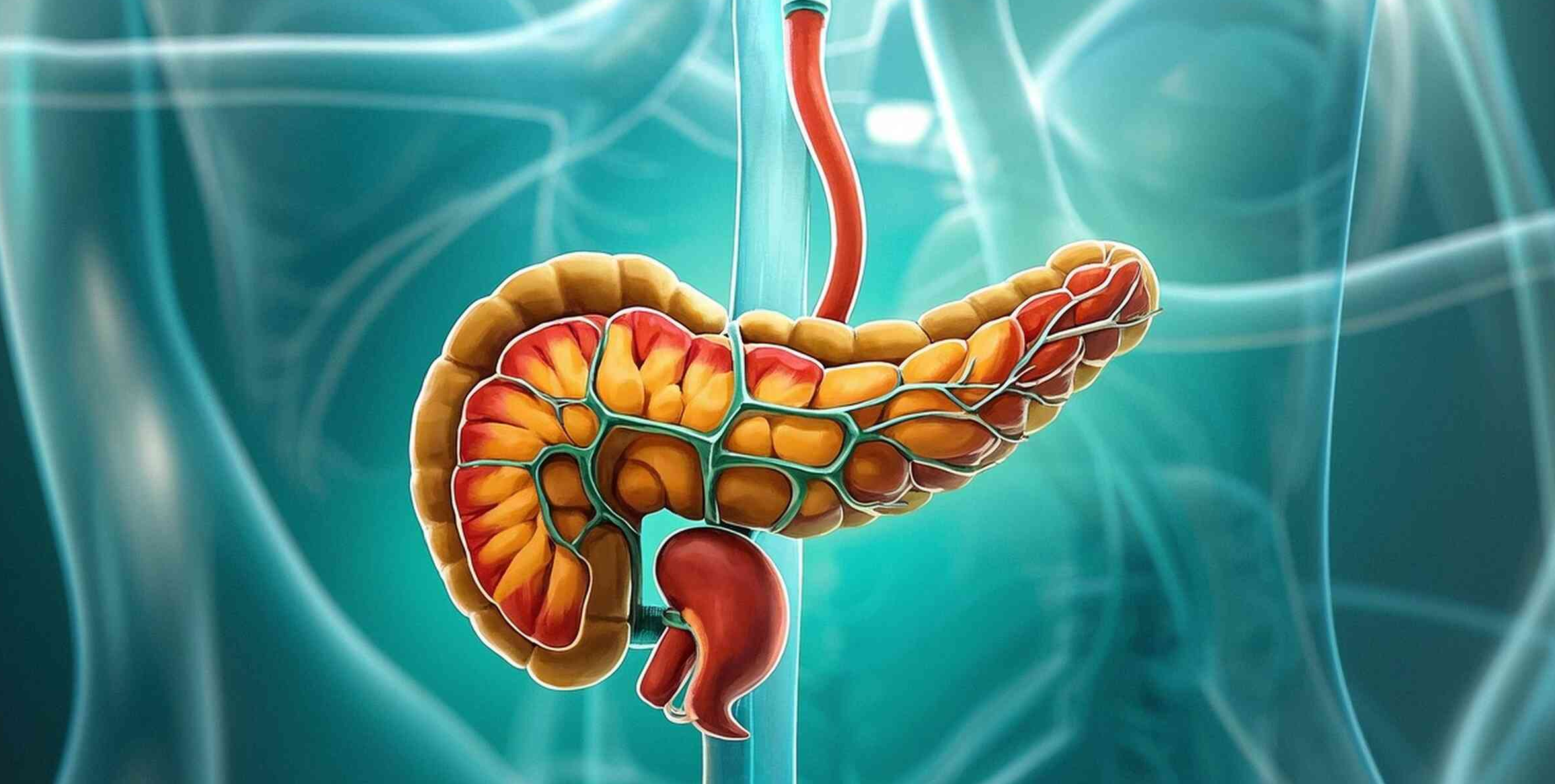 系統性保護！間充質干細胞療法為重癥胰腺炎帶來新曙光