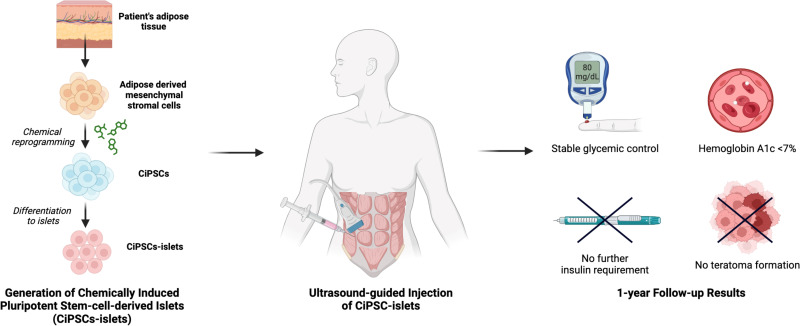 圖示：?通過將患者脂肪組織提取的間充質干細胞化學重編程為誘導多能干細胞并分化為胰島，再注射入腹直肌前鞘。