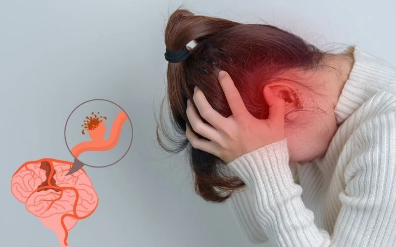 神經干細胞移植治療腦出血:機制、療效與轉化前景