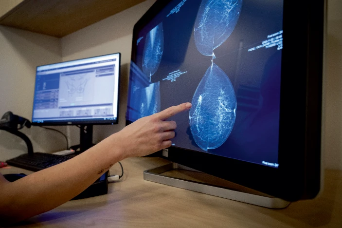 轉移性乳腺癌患者迫切需要新的治療方法。 轉移性乳腺癌患者迫切需要新的治療方法。