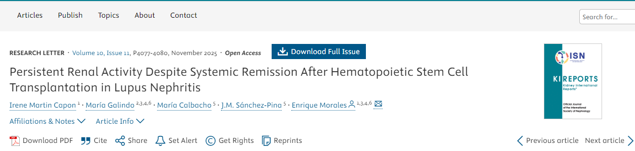 狼瘡性腎炎患者接受造血干細胞移植后，盡管全身癥狀緩解，但腎臟活動仍持續(xù)存在