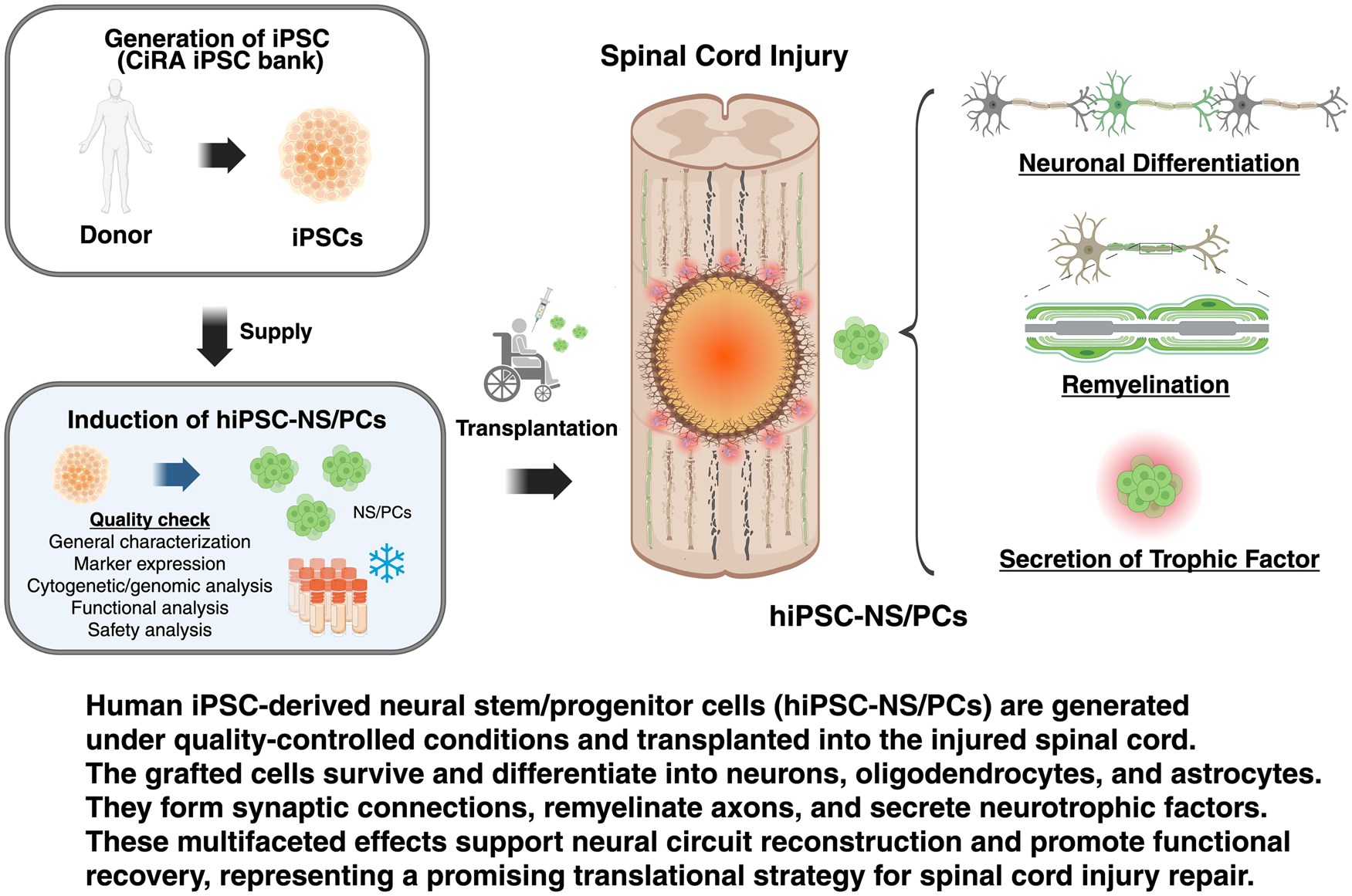 最新綜述!多能干細胞來源的神經干/祖細胞療法治療脊髓損傷:臨床進展和轉化展望 最新綜述!多能干細胞來源的神經干/祖細胞療法治療脊髓損傷:臨床進展和轉化展望