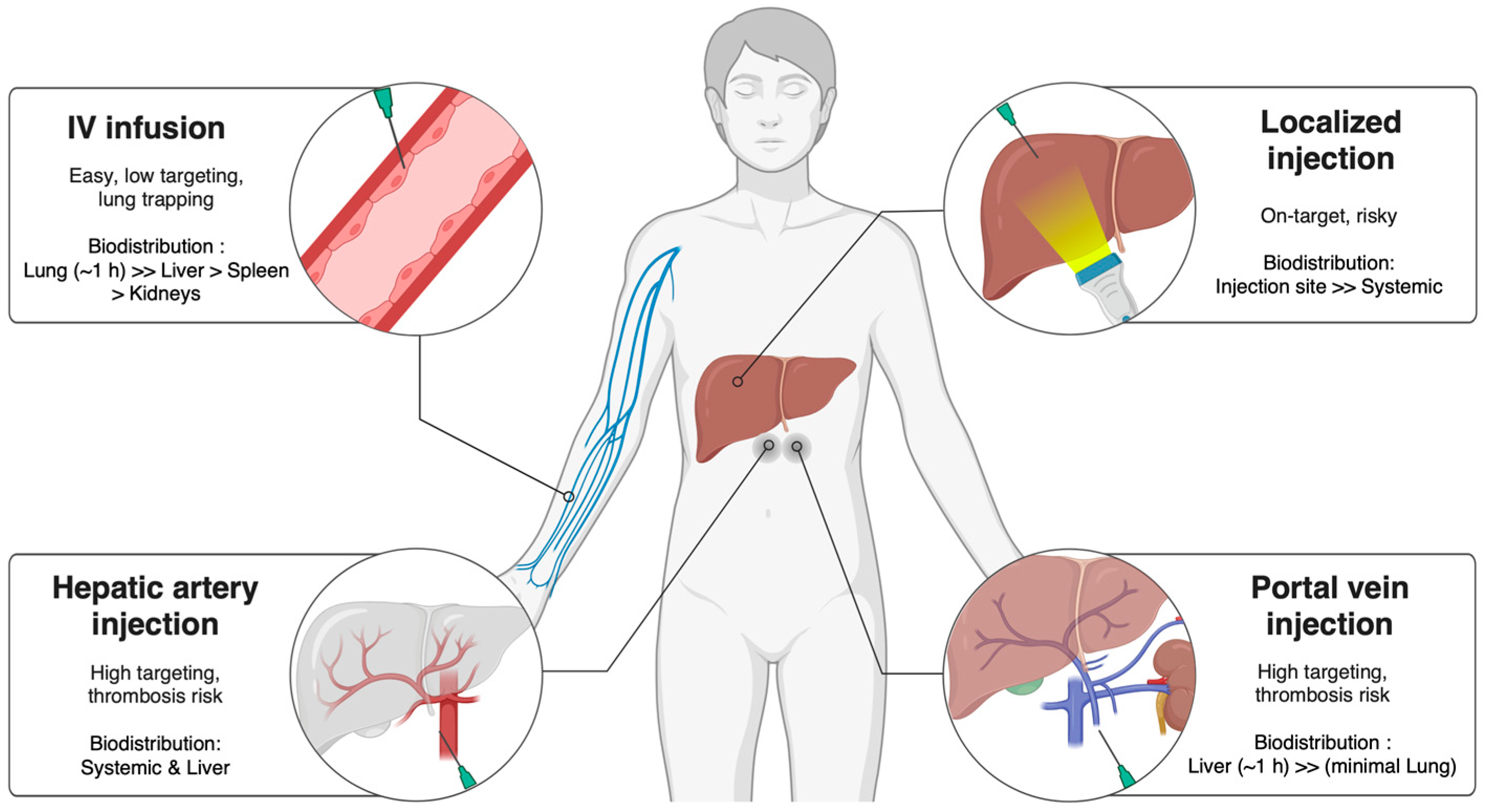 圖2:MSCs和EVs在肝病治療中的遞送途徑。生物分布和治療效果會受到給藥途徑的影響,例如靜脈注射、門靜脈注射、肝動脈注射或局部注射。 圖2:MSCs和EVs在肝病治療中的遞送途徑。生物分布和治療效果會受到給藥途徑的影響,例如靜脈注射、門靜脈注射、肝動脈注射或局部注射。
