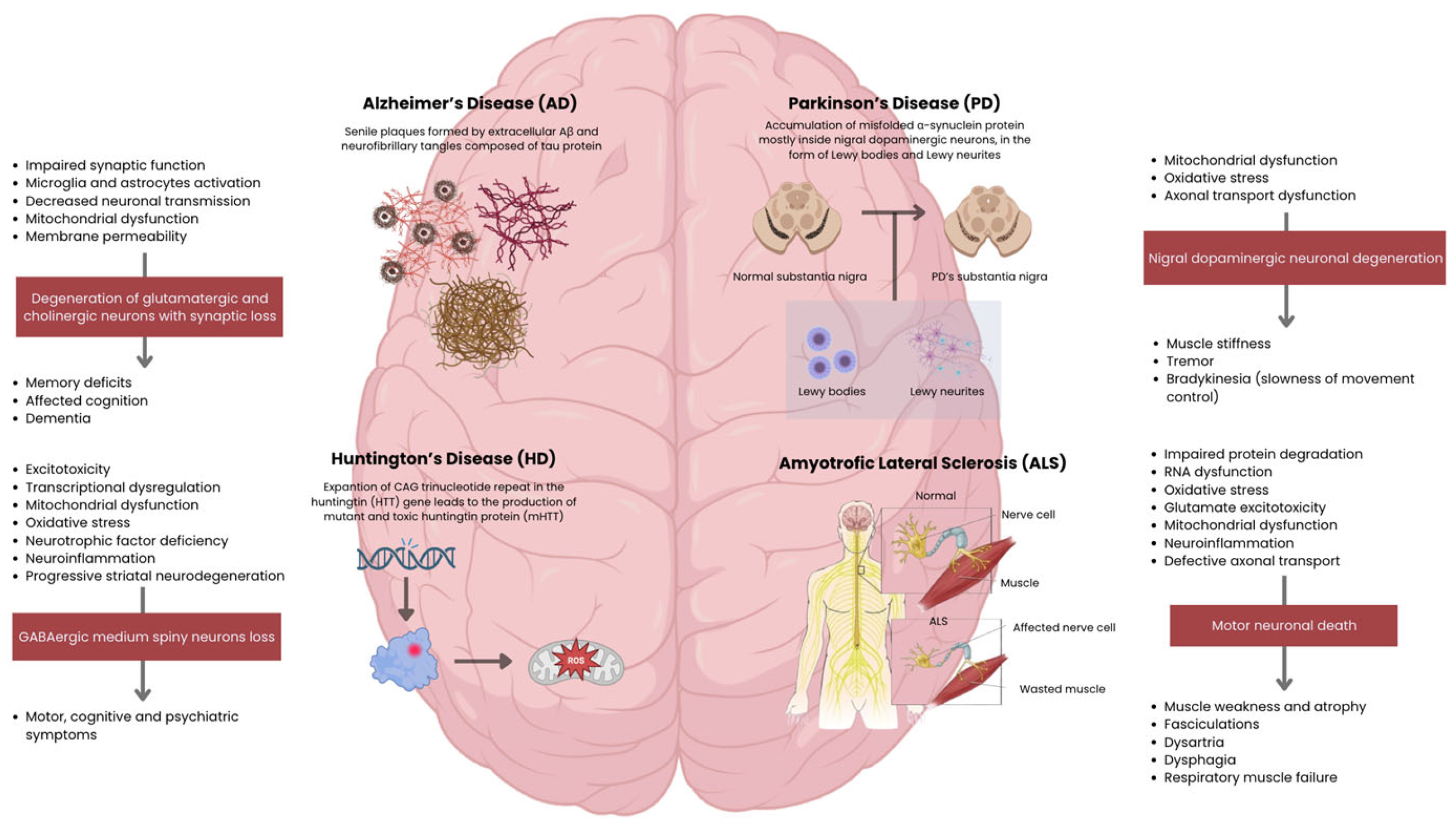圖2：主要神經(jīng)退行性疾病的病理生理機(jī)制和臨床特征。側(cè)邊欄概述了從細(xì)胞功能障礙到特定神經(jīng)元丟失以及隨后的臨床表現(xiàn)的進(jìn)展過(guò)程。