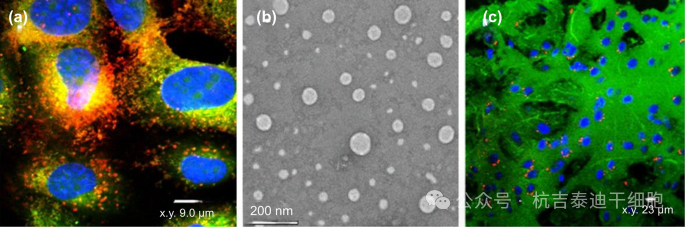 圖1:細胞、組織和透射電鏡 (TEM) 下的小型細胞外囊泡 (sEVs)。細胞產生的 sEVs(例如,外泌體)直徑為 30–150 nm,可以穿過血腦屏障。 圖1:細胞、組織和透射電鏡 (TEM) 下的小型細胞外囊泡 (sEVs)。細胞產生的 sEVs(例如,外泌體)直徑為 30–150 nm,可以穿過血腦屏障。