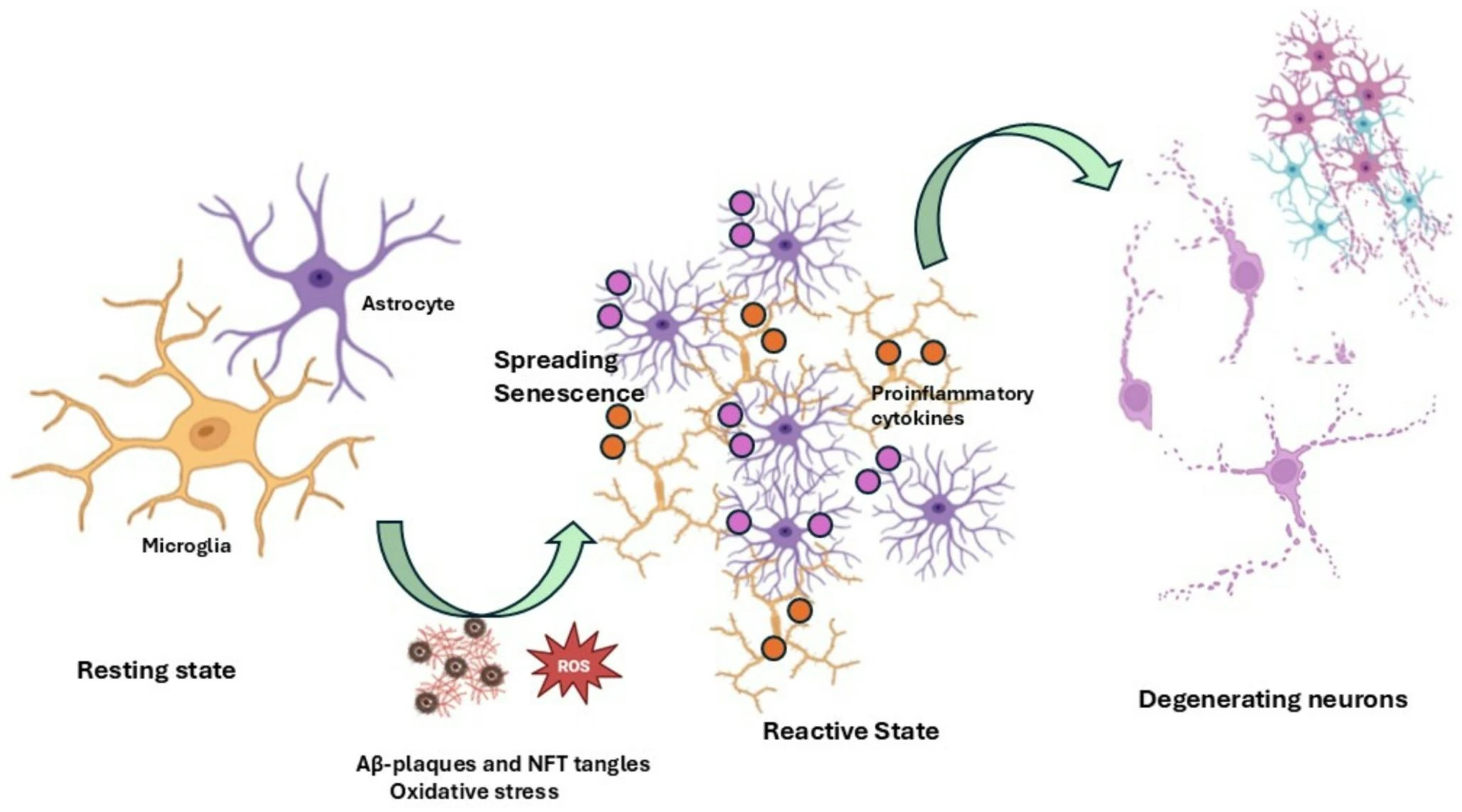 圖2：膠質細胞衰老引發的神經炎癥與神經元退化。示意圖顯示，在生理條件下，星形膠質細胞和小膠質細胞通過保持靜息狀態來協助神經元存活并維持大腦穩態。